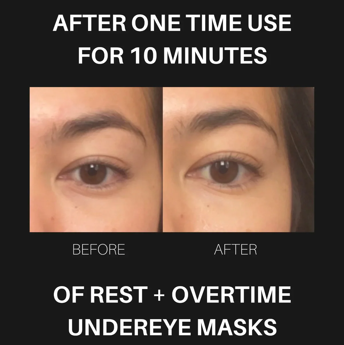 Overtime Undereye Masks - Image 4