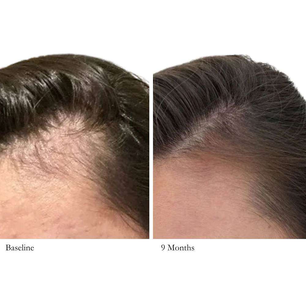 Professional Scalp Care Shampoo - Image 6