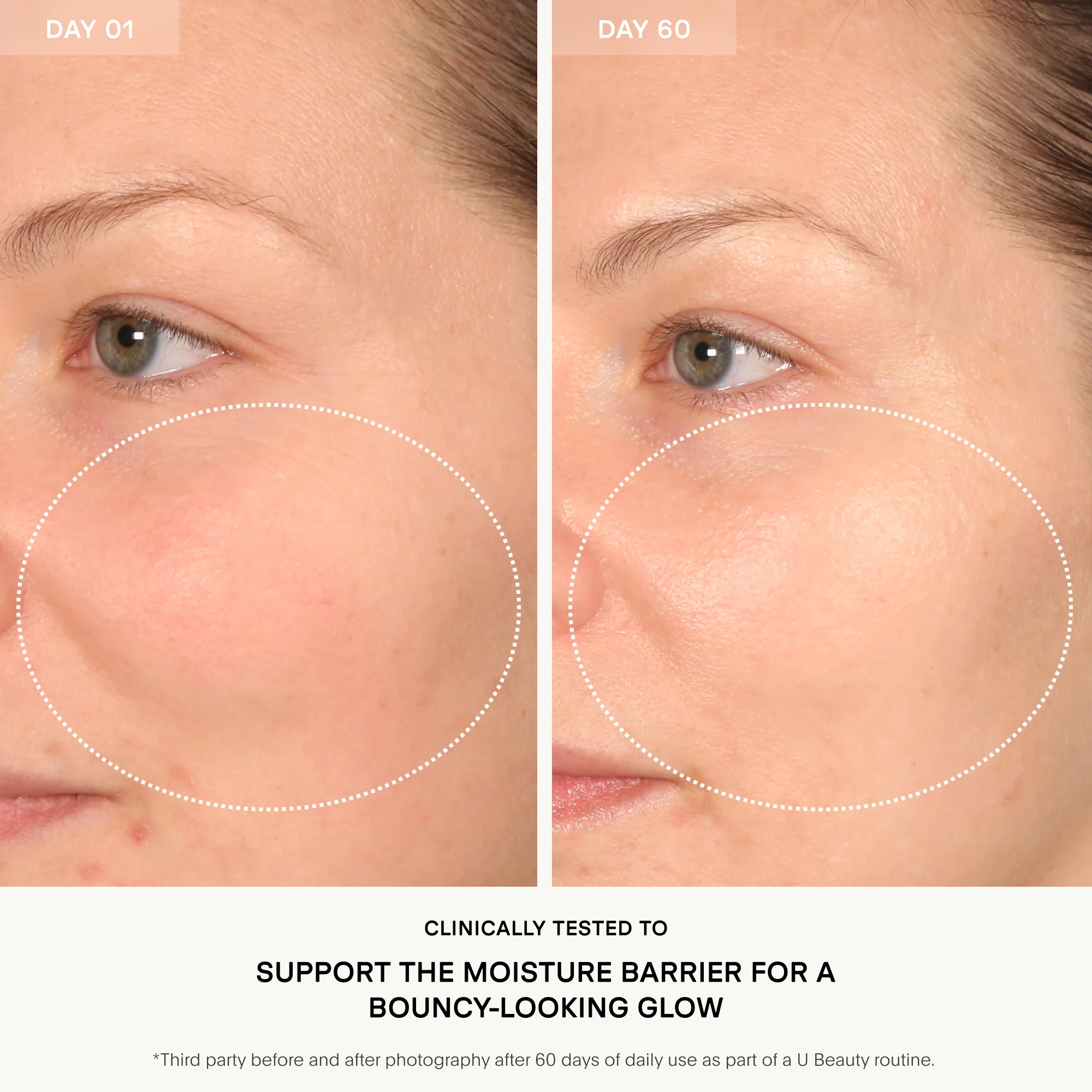 The BARRIER Bioactive Treatment - Image 5