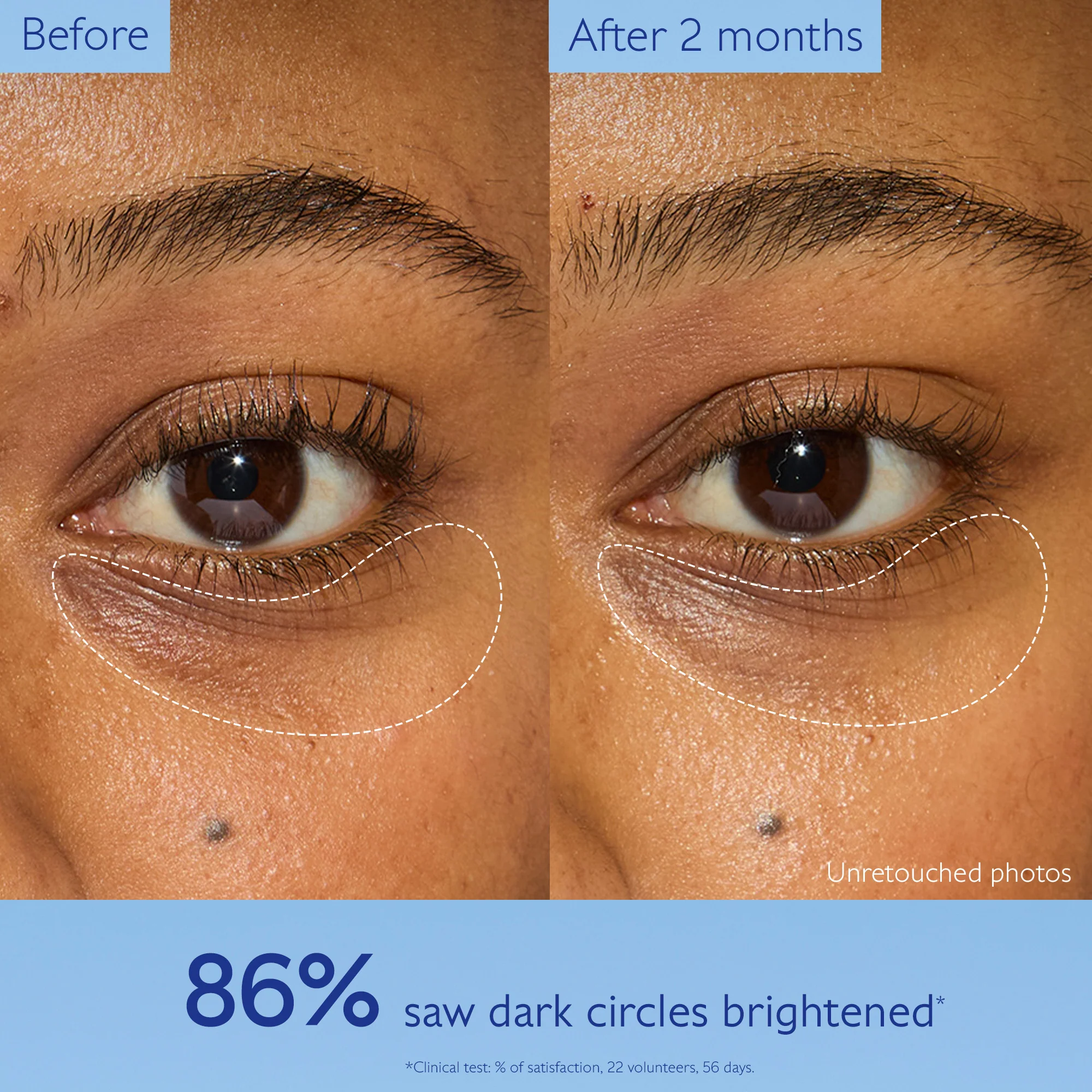 Vinoperfect Brightening Eye Cream - Image 3