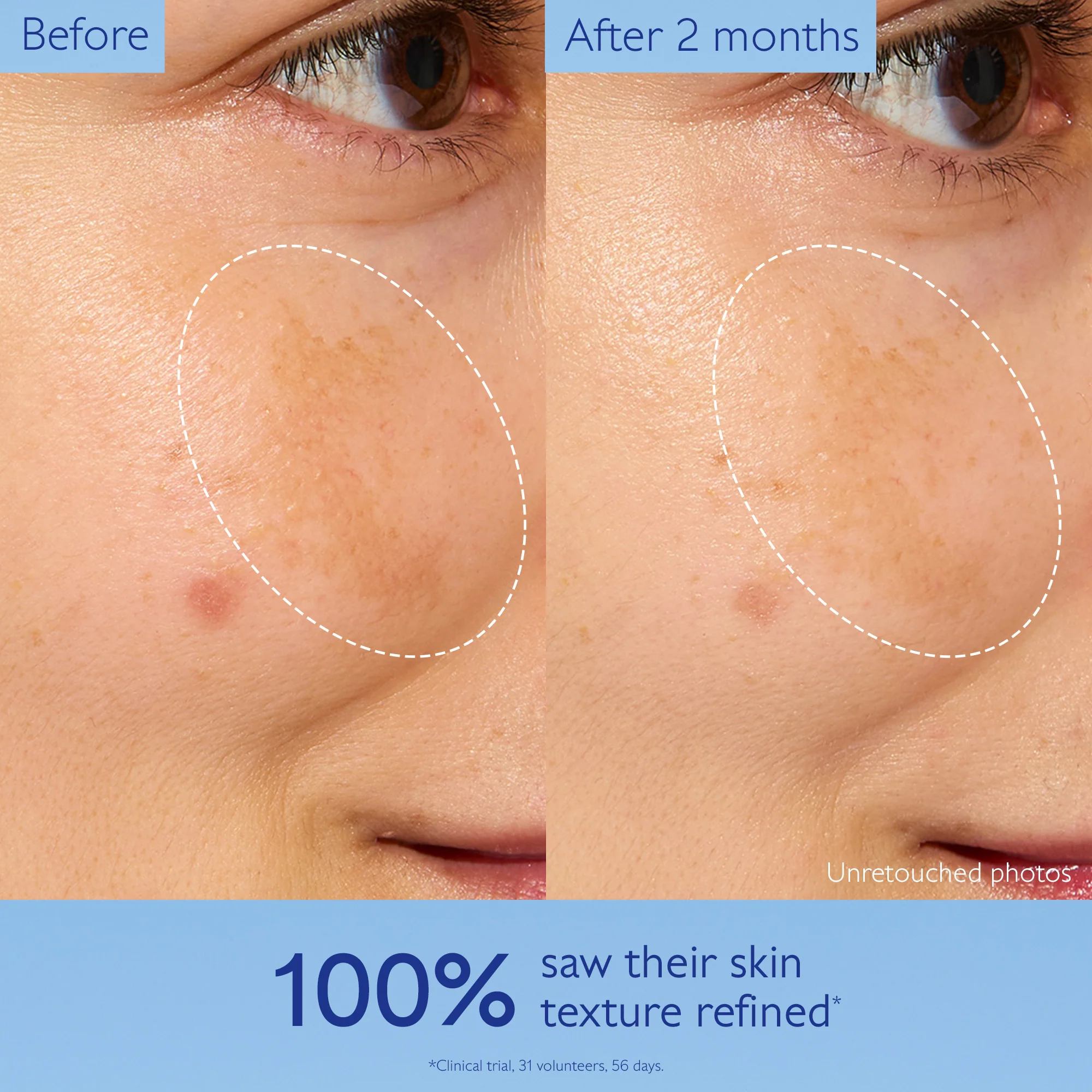 Vinoperfect Brightening Glycolic Essence - Image 4