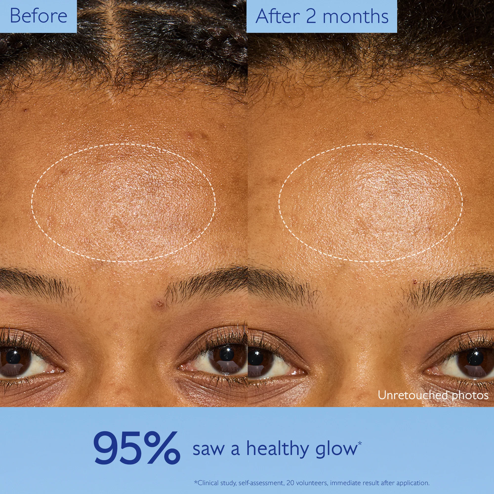 Vinoperfect Dark Spot Niacinamide Moisturizer - Image 4
