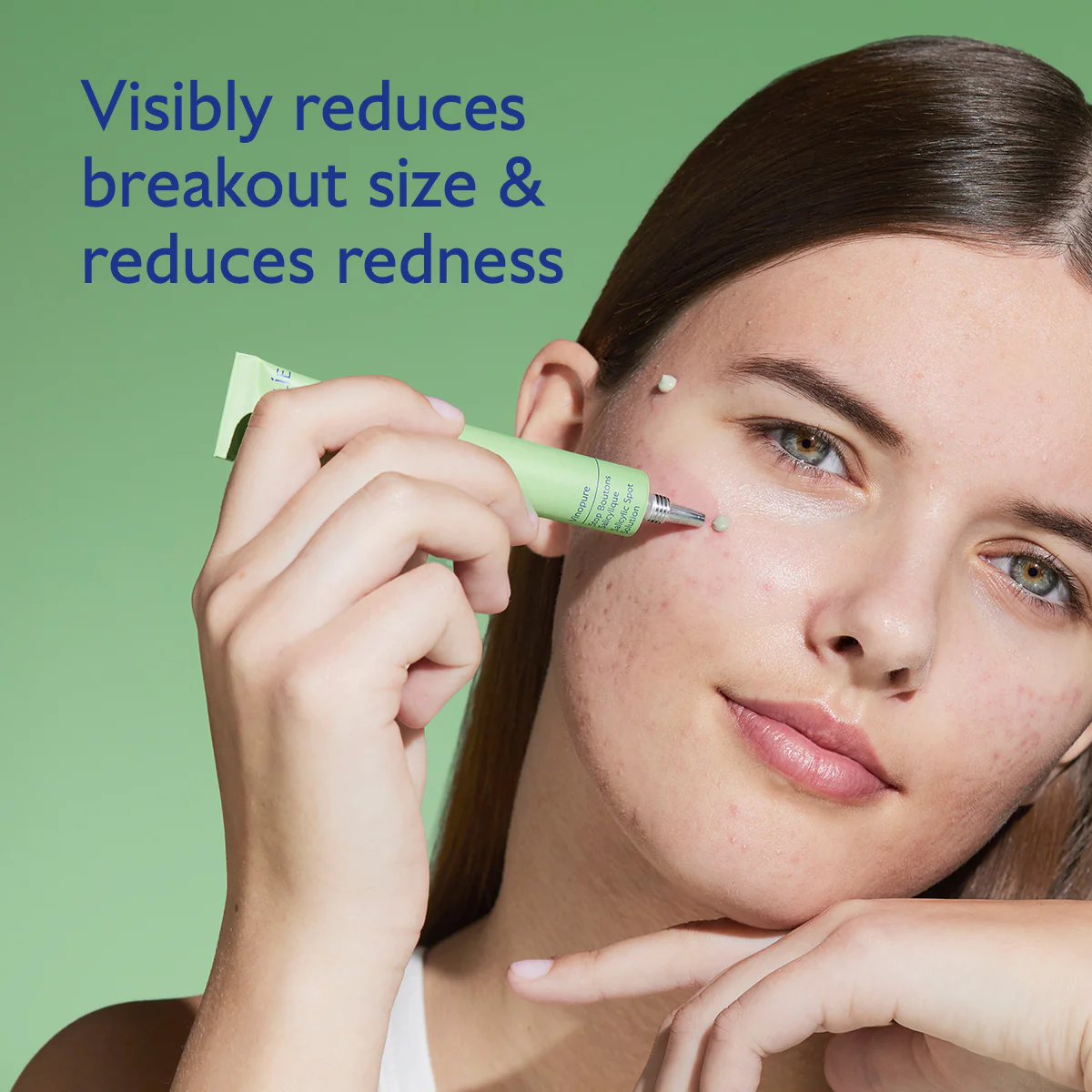 Vinopure Salicylic Spot Solution - Image 3